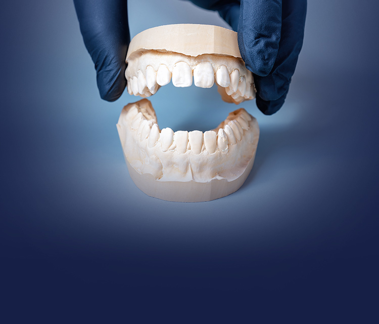 Implant Placement